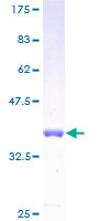 ab152918 on a 12.5% SDS-PAGE stained with Coomassie Blue.