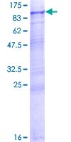 ab163384 on a 12.5% SDS-PAGE stained with Coomassie Blue.
