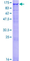 ab159021 on a 12.5% SDS-PAGE stained with Coomassie Blue.