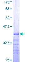 ab159022 on a 12.5% SDS-PAGE stained with Coomassie Blue.