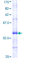 ab158767 on a 12.5% SDS-PAGE stained with Coomassie Blue.