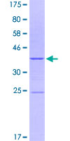 ab158772 on a 12.5% SDS-PAGE stained with Coomassie Blue.