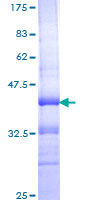 ab158773 on a 12.5% SDS-PAGE stained with Coomassie Blue.