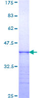 ab158769 on a 12.5% SDS-PAGE stained with Coomassie Blue.
