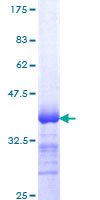 ab158777 on a 12.5% SDS-PAGE stained with Coomassie Blue.