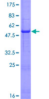 ab158732 on a 12.5% SDS-PAGE stained with Coomassie Blue.