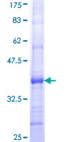 ab158733 on a 12.5% SDS-PAGE stained with Coomassie Blue.