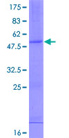 ab158734 on a 12.5% SDS-PAGE stained with Coomassie Blue.