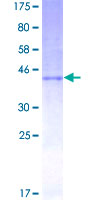 ab158739 on a 12.5% SDS-PAGE stained with Coomassie Blue.