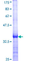 ab158740 on a 12.5% SDS-PAGE stained with Coomassie Blue.