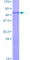 ab158518 on a 12.5% SDS-PAGE stained with Coomassie Blue.