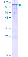 ab164892 on a 12.5% SDS-PAGE stained with Coomassie Blue.
