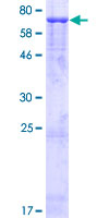 12.5% SDS-PAGE analysis of ab152441 stained with Coomassie Blue.