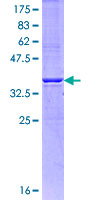 ab158779 on a 12.5% SDS-PAGE stained with Coomassie Blue.