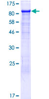 ab164240 on a 12.5% SDS-PAGE stained with Coomassie Blue.