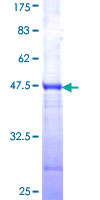 ab164241 on a 12.5% SDS-PAGE stained with Coomassie Blue.