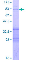 ab160660 on a 12.5% SDS-PAGE stained with Coomassie Blue.