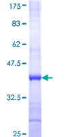 ab163875 on a 12.5% SDS-PAGE stained with Coomassie Blue.