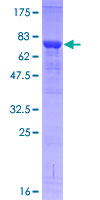 ab153333 on a 12.5% SDS-PAGE stained with Coomassie Blue.
