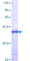 ab153334 on a 12.5% SDS-PAGE stained with Coomassie Blue.