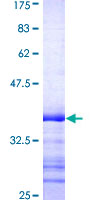ab153170 on a 12.5% SDS-PAGE stained with Coomassie Blue.