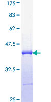 ab158770 on a 12.5% SDS-PAGE stained with Coomassie Blue.