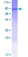 ab163376 on a 12.5% SDS-PAGE stained with Coomassie Blue.