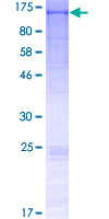 ab164386 on a 12.5% SDS-PAGE stained with Coomassie Blue.