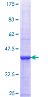 ab164387 on a 12.5% SDS-PAGE stained with Coomassie Blue.