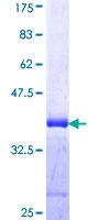 ab160911 on a 12.5% SDS-PAGE stained with Coomassie Blue.