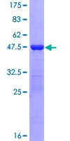 ab158771 on a 12.5% SDS-PAGE stained with Coomassie Blue.