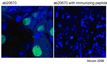 Dorsal root ganglion explants were dissected from 16 day-old rat embryos and cultured for 6 hours in vitro with Neurobasal Medium containing B27 supplement. Nuclei stained positive for anti-Islet 1 antibody ab20670 at 2µg/ml. As would be expected, not all cells in this preparation were Islet 1-positive. Pre-incubation of ab20670 with the immunizing peptide ab21996 resulted in complete blocking of the antibody. Green = ab20670 Blue = To-pro-3 nuclear stain The level of magnification is different in each image.