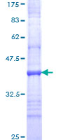 ab160069 on a 12.5% SDS-PAGE stained with Coomassie Blue.