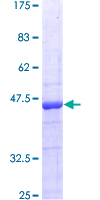ab160407 on a 12.5% SDS-PAGE stained with Coomassie Blue.