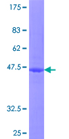 ab160408 on a 12.5% SDS-PAGE stained with Coomassie Blue.