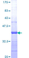 ab160409 on a 12.5% SDS-PAGE stained with Coomassie Blue.