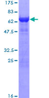 ab162009 on a 12.5% SDS-PAGE stained with Coomassie Blue.