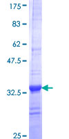 ab162010 on a 12.5% SDS-PAGE stained with Coomassie Blue.