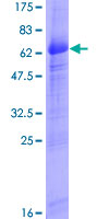 ab160492 on a 12.5% SDS-PAGE stained with Coomassie Blue.