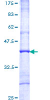 ab160493 on a 12.5% SDS-PAGE stained with Coomassie Blue.