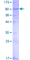 ab164760 on a 12.5% SDS-PAGE stained with Coomassie Blue.