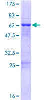 ab165981 on a 12.5% SDS-PAGE stained with Coomassie Blue.