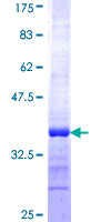 ab153592 on a 12.5% SDS-PAGE stained with Coomassie Blue.