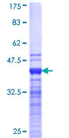 ab153629 on a 12.5% SDS-PAGE stained with Coomassie Blue.