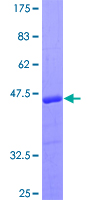 ab159219 on a 12.5% SDS-PAGE stained with Coomassie Blue.