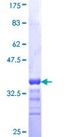 ab163397 on a 12.5% SDS-PAGE stained with Coomassie Blue.