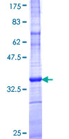 ab161039 on a 12.5% SDS-PAGE stained with Coomassie Blue.