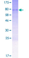ab161615 on a 12.5% SDS-PAGE stained with Coomassie Blue.