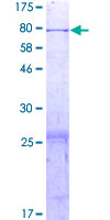 ab164590 on a 12.5% SDS-PAGE stained with Coomassie Blue.