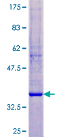 ab162332 on a 12.5% SDS-PAGE stained with Coomassie Blue.